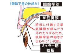 眼瞼下垂ってなあに? 保険で治せるの? 気になるその症状と治療法