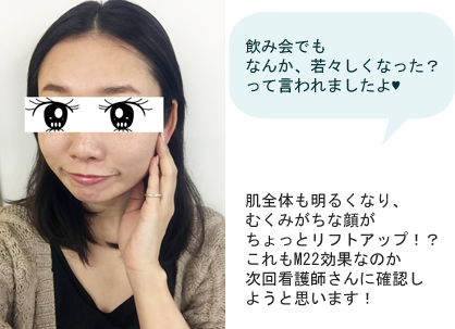【フォトフェイシャルM22】1クール(5回)の治療でシミ・ソバカスはどこまで薄くなるのか検証!