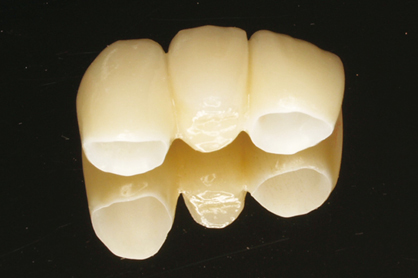 【審美治療特集】綺麗な歯は美人の条件
