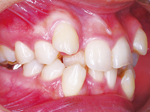 【審美治療特集】綺麗な歯は美人の条件