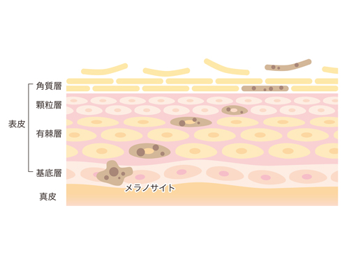 日本人（黄色人種）の肌は炎症後色素沈着（PIH）が起こりやすい！
