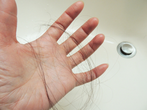 女性特有の薄毛「びまん性脱毛症」の傾向と対策！ 抜け毛、増えていませんか？
